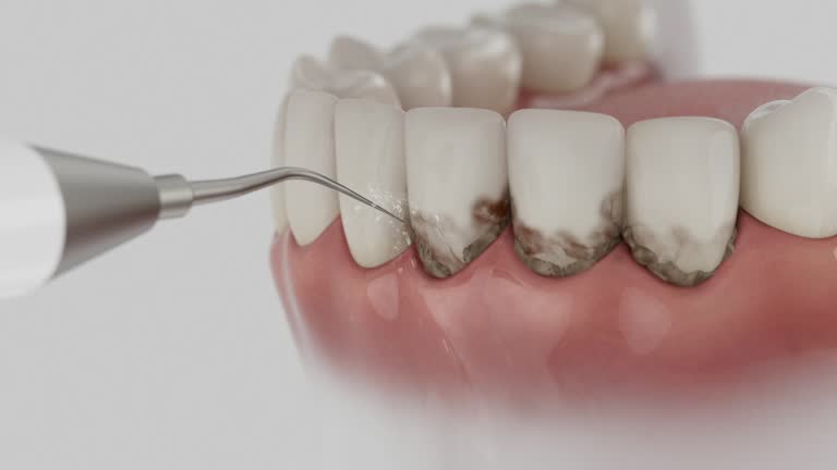 Reliable Teeth Cleaning And Checkup contractor in Jones County County, SD by Dentist Open Now